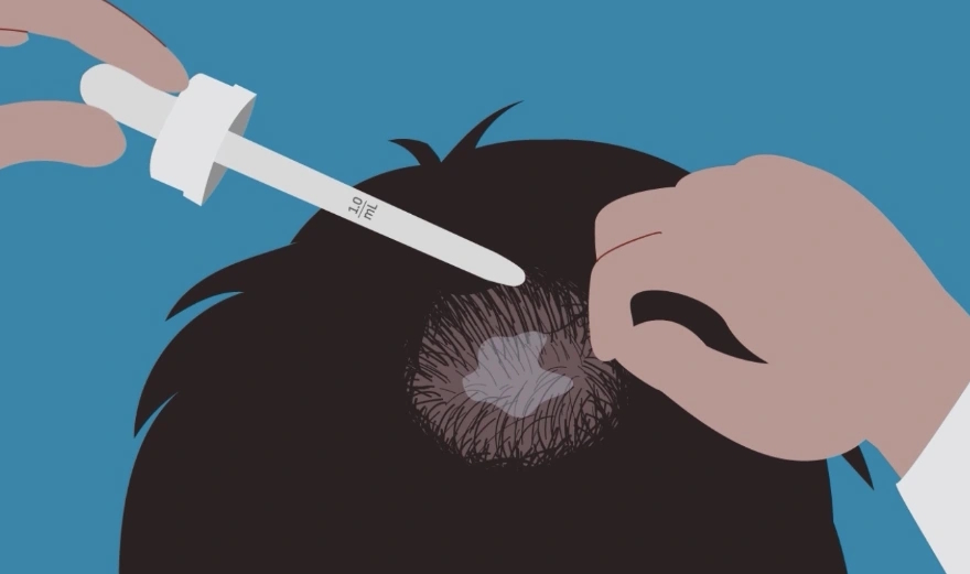 Minoxidil Kirkland 5% 360ML (6X60ML)